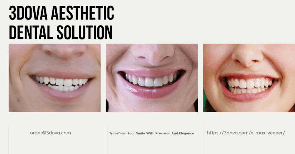 E-Max Veneer Smile Design | 3DOVA Custom Aesthetic Solutions