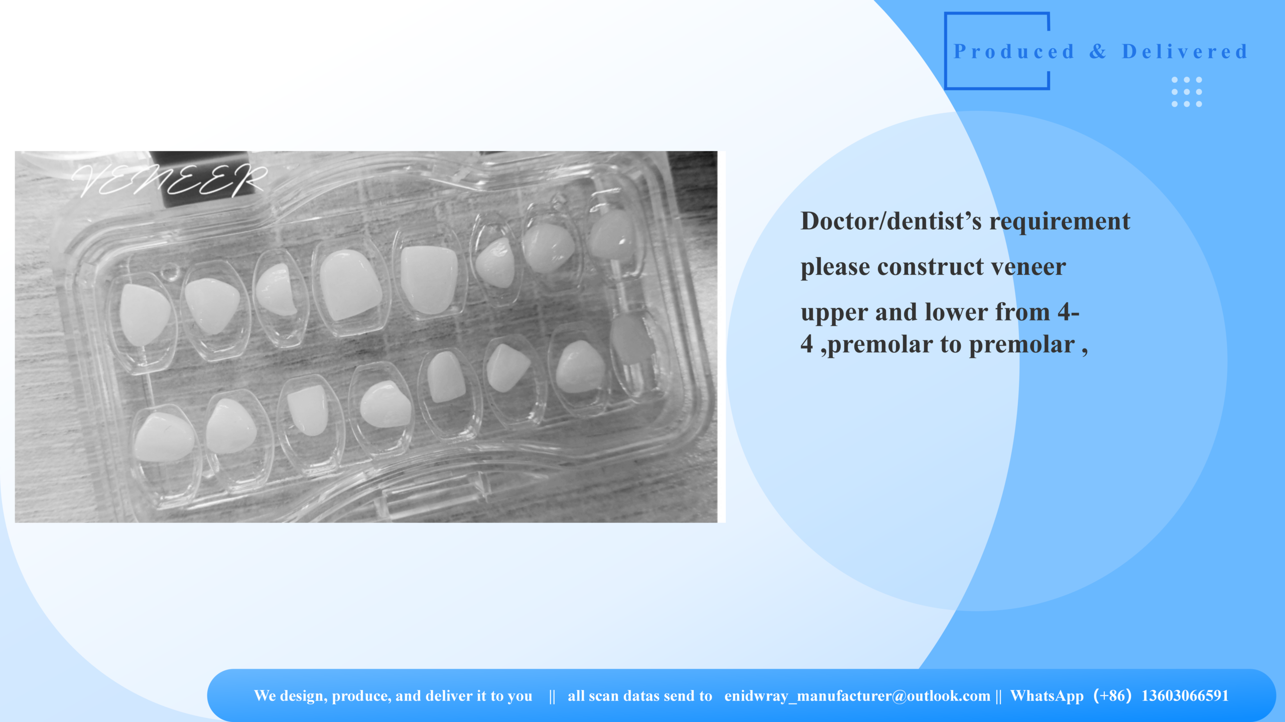 E-Max Veneer Smile Design | 3DOVA Custom Aesthetic Solutions