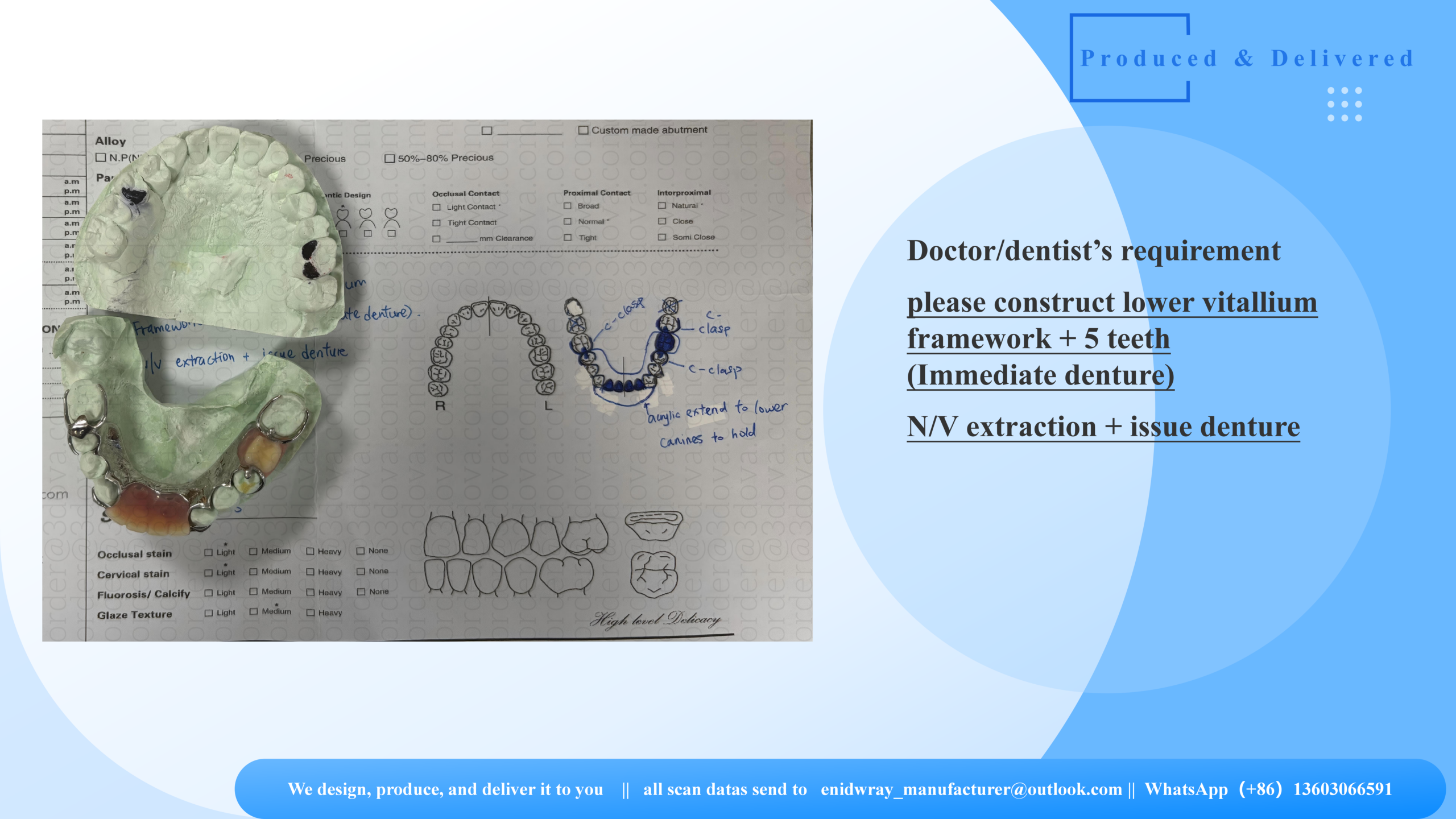 Vitallium Framework Denture – Ready for Immediate Use