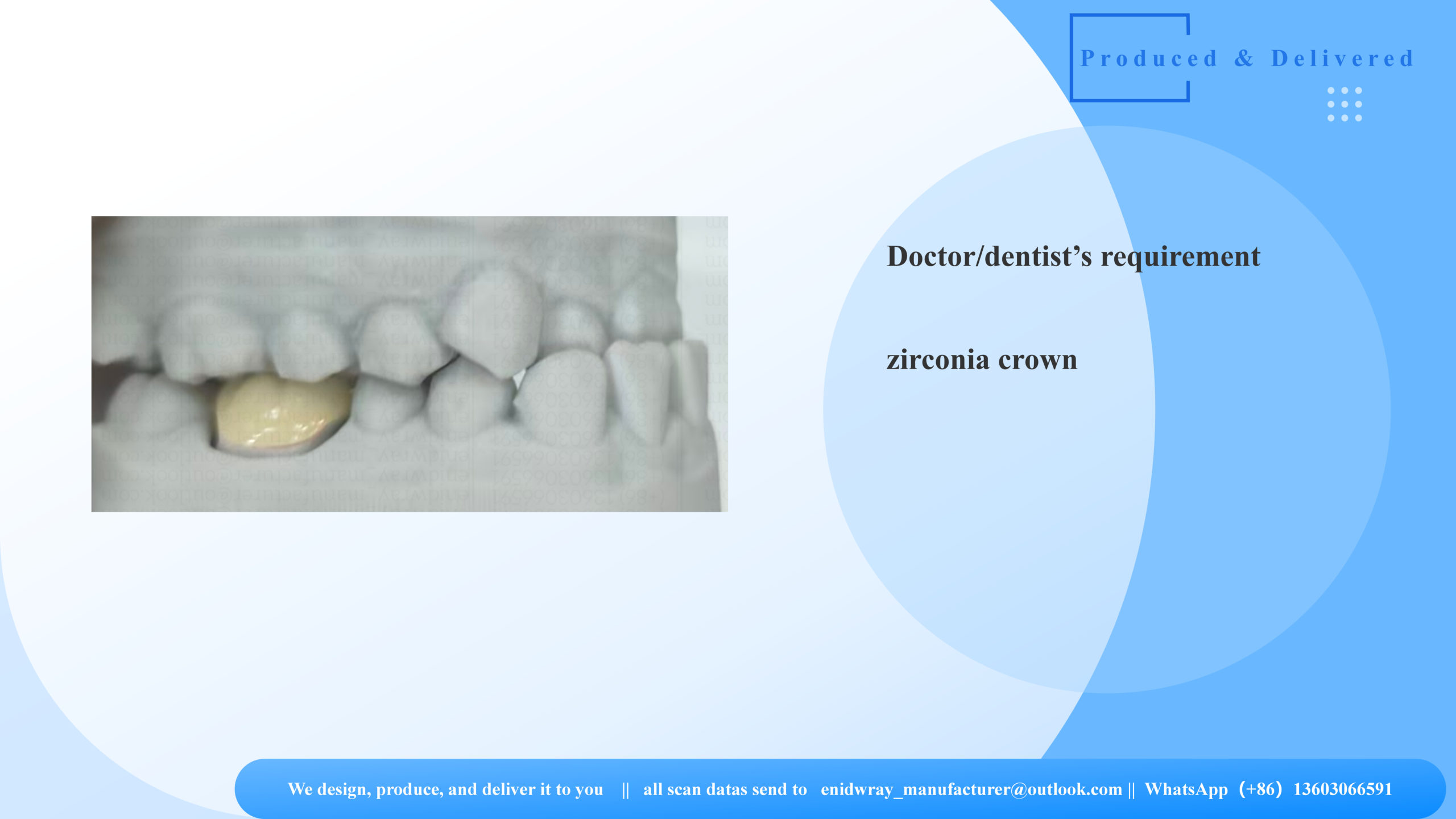 Zirconia Crown Bridge | Porcelain-Layered, Metal-Free Strength