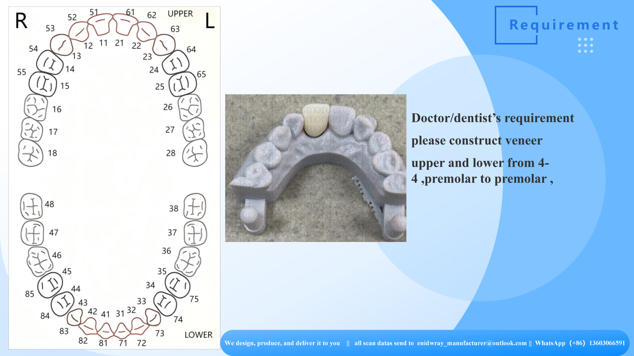 Full Zirconia Crown/Bridge
