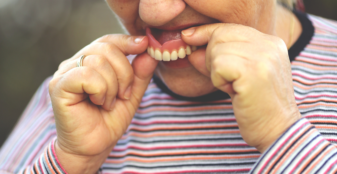 complete acrylic denture with natural tooth anatomy