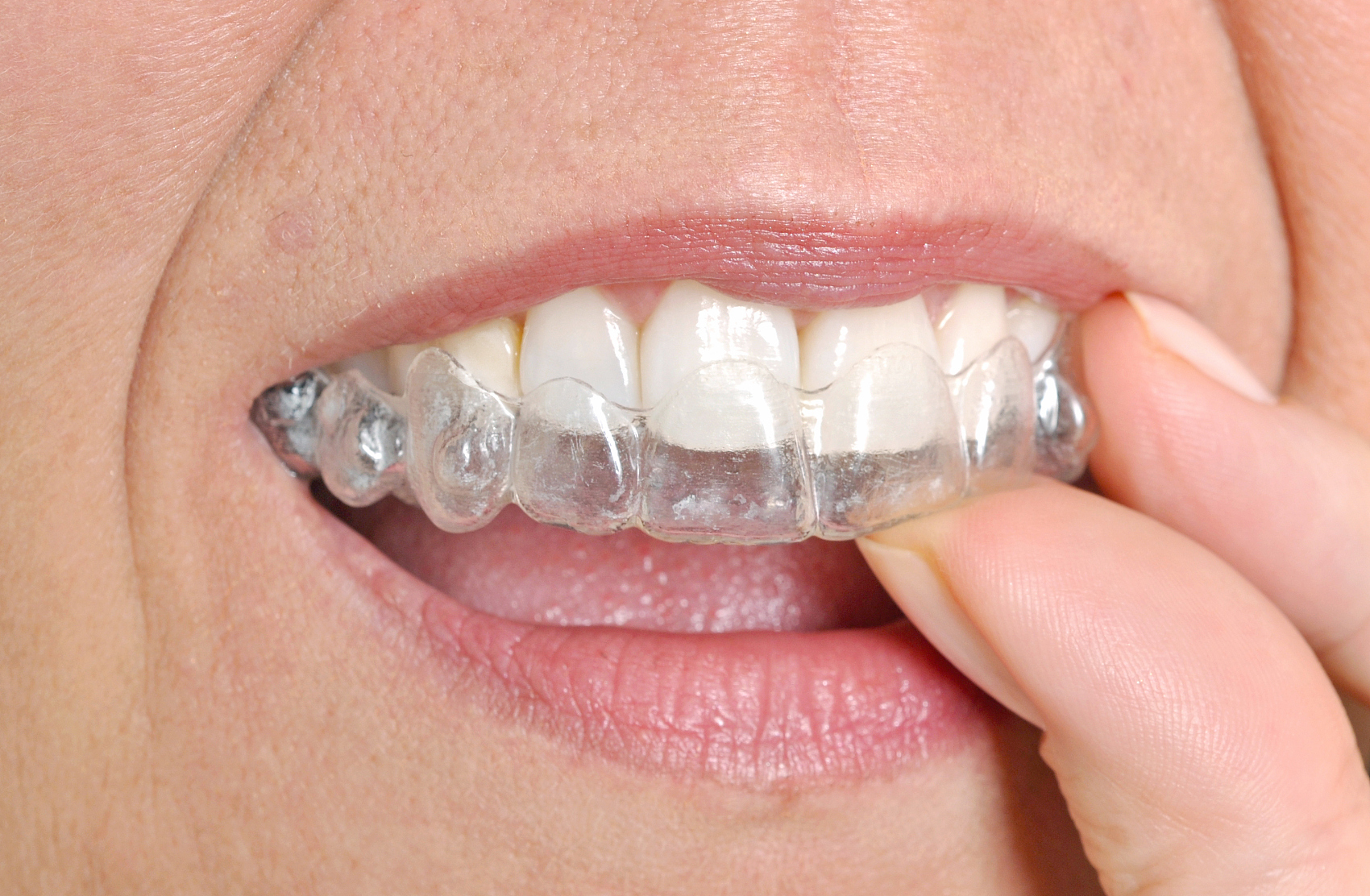 Zirconia crown and bridge set milled with CAD CAM