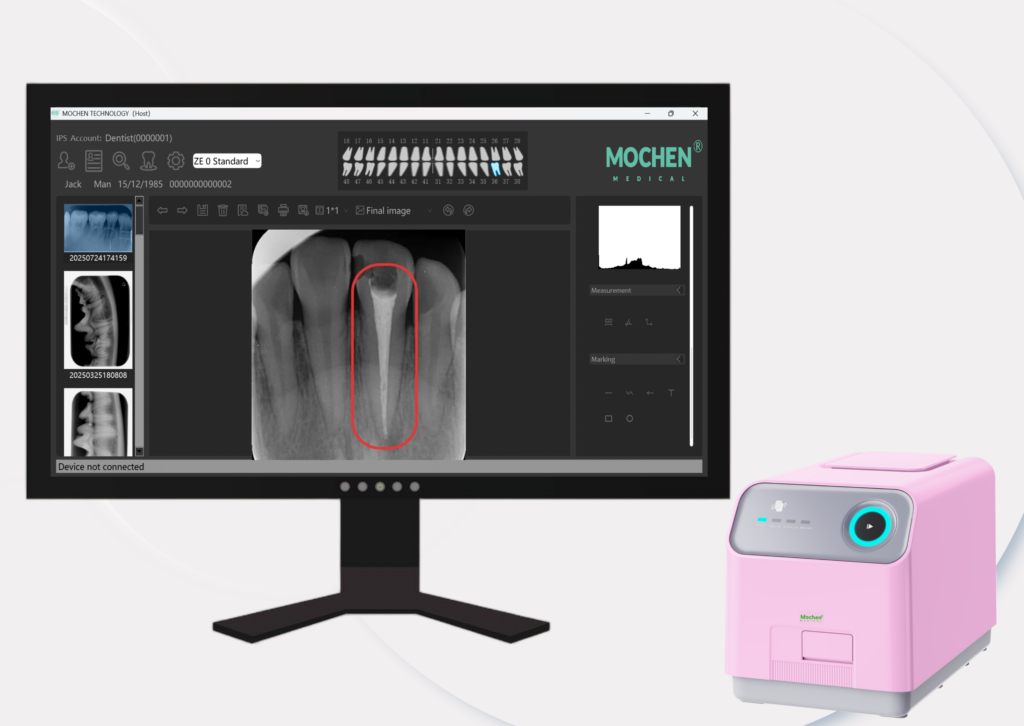 Dental PSP Scanner