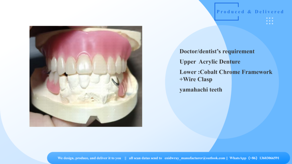 Upper complete acrylic denture and lower Cobalt Chrome Framework mounted on a semi-adjustable articulator for dental occlusion check.