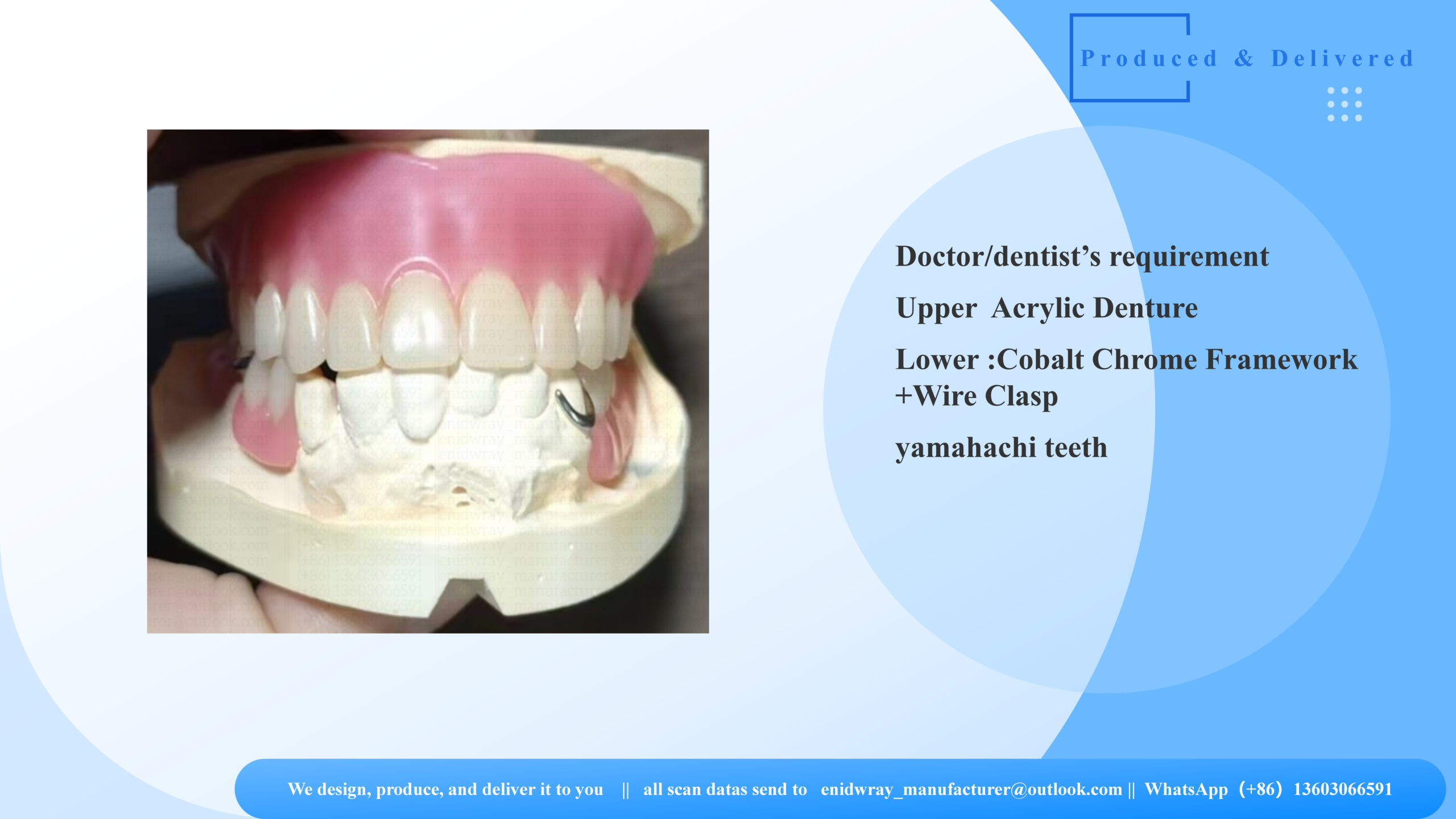 Removable Partial Denture Case Study: Cobalt Chrome Design