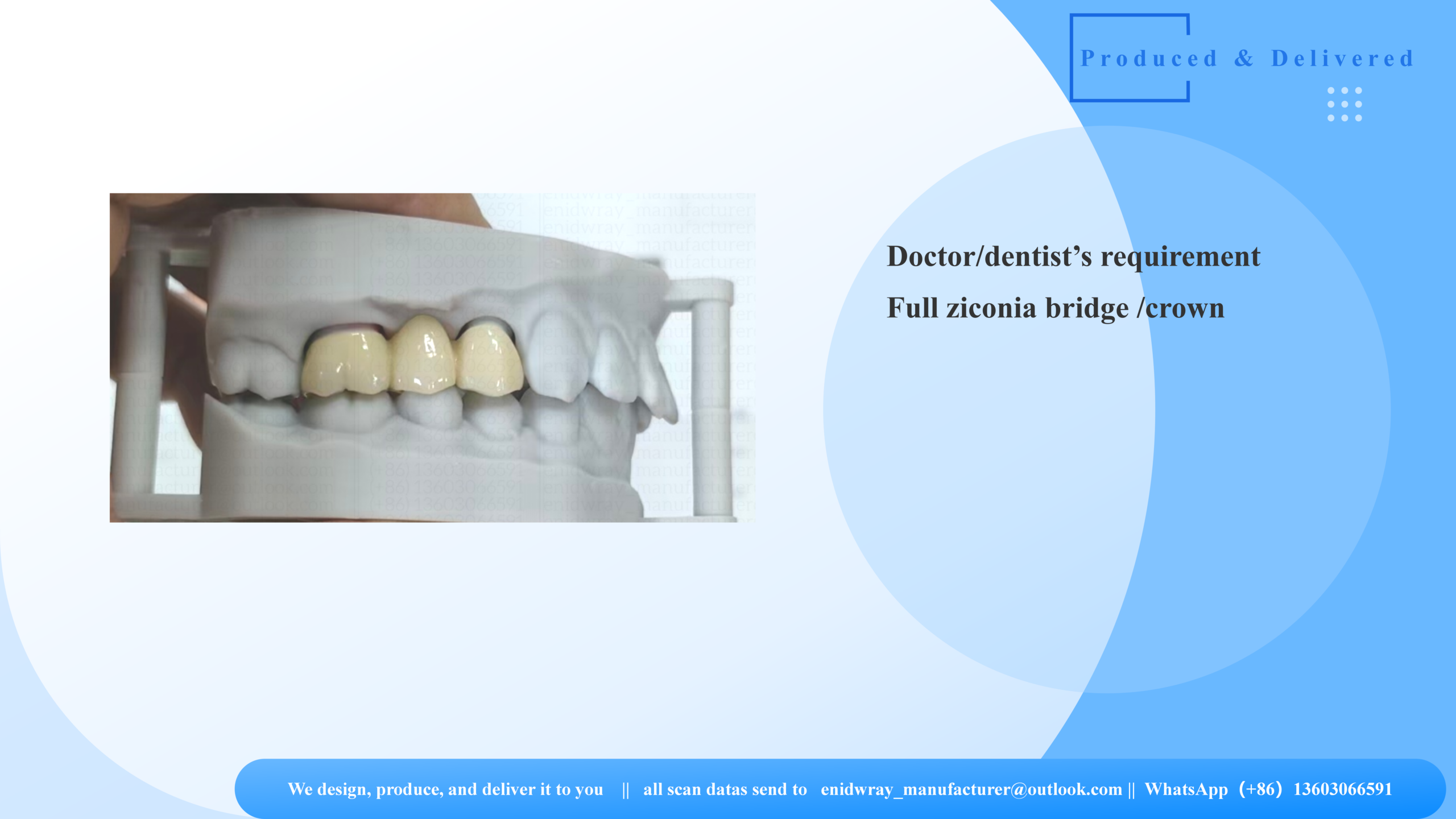 Full Zirconia Bridge & Crown Case Study: Shade A2