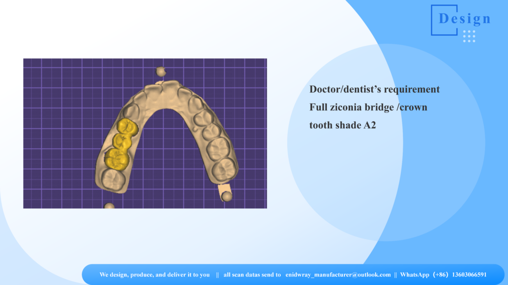 A full zirconia dental bridge sitting on a physical master model being inspected under a high-magnification microscope for perfect marginal fit.