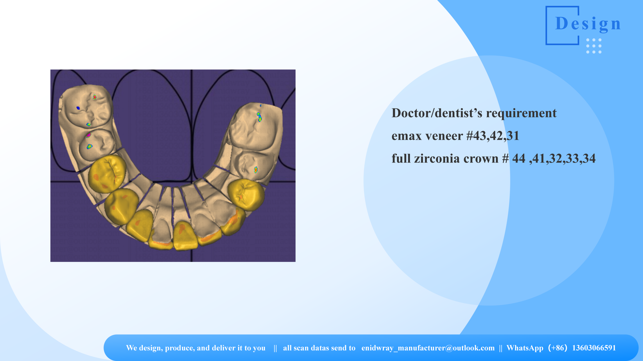 Zirconia and e.max Combinations | 3DOVA Lab