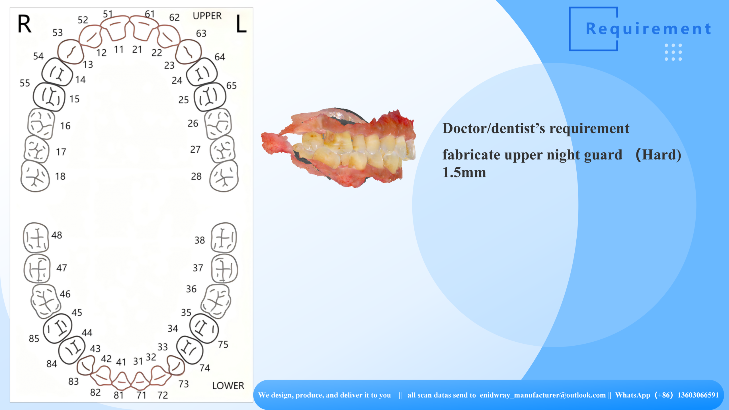 Hard Night Guards: High-Precision Solutions for Modern Dentists