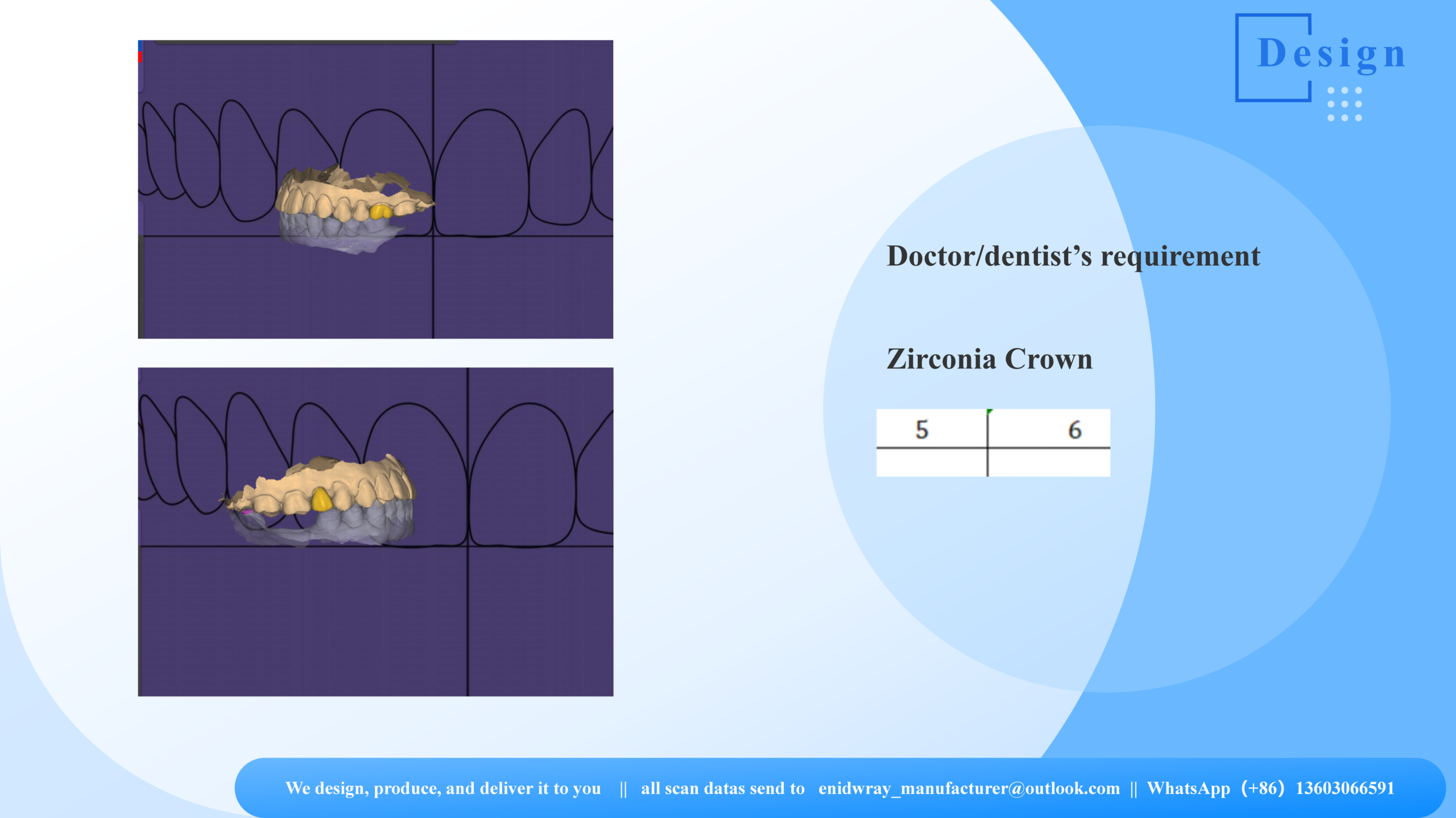 CAD/CAM Zirconia Crown Fabrication | 3DOVA Lab
