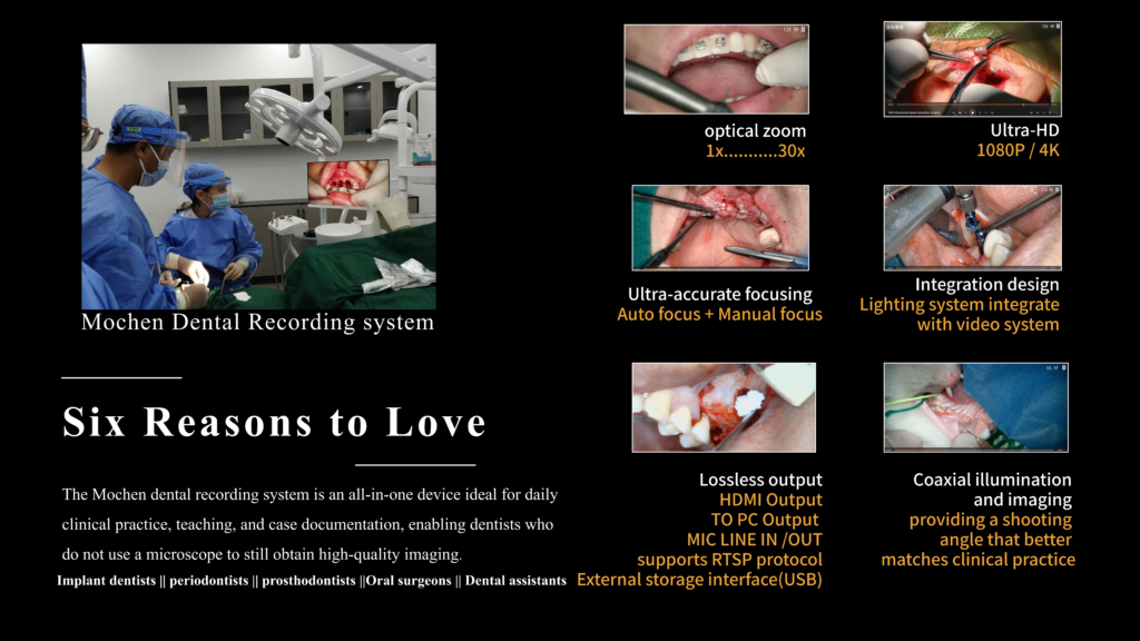 Dental intraoral video feed demonstration showing 30x optical zoom and 4K color accuracy