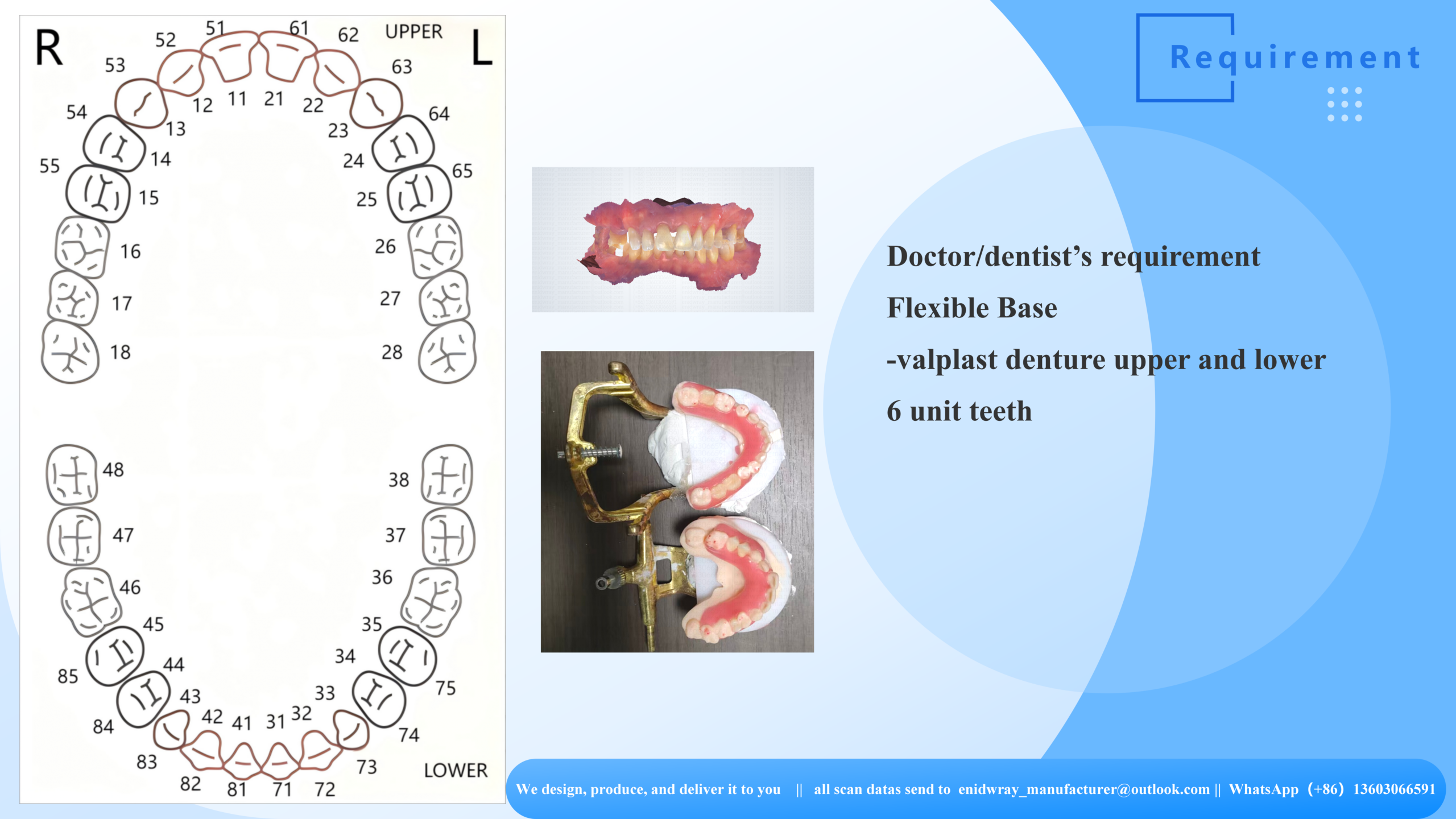 Flexible Partial Denture Lab | Digital CAD/CAM Certified Valplast