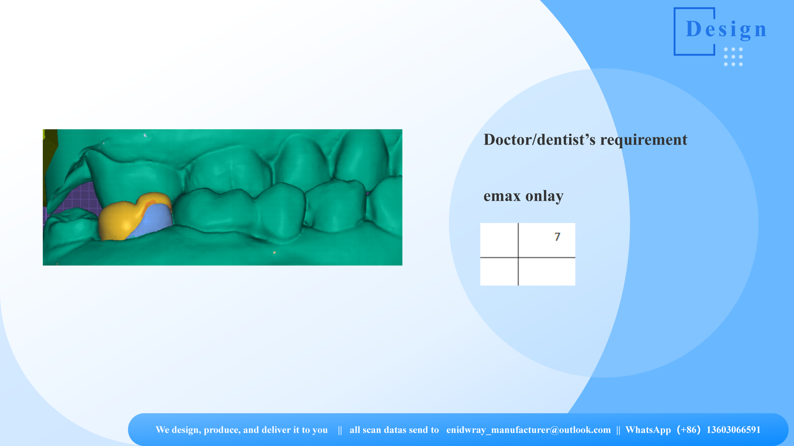 emax onlay Restorations | Premium CAD/CAM By 3DOVA