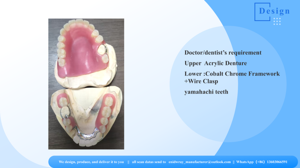 Finished premium upper acrylic denture and lower partial Cobalt Chrome Framework restoration ready for clinical delivery.
