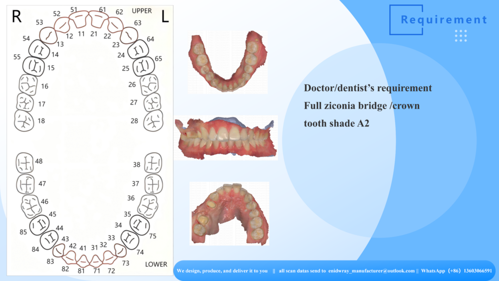 Finished premium Shade A2 full zirconia bridge and single crown showcasing lifelike halo effects and natural tooth anatomy.