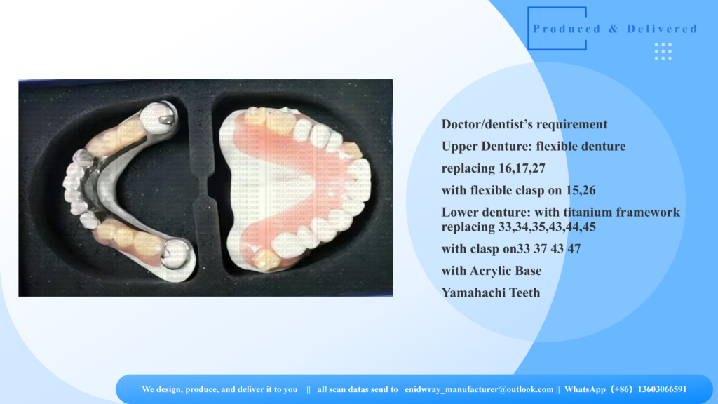 Finished premium upper flexible denture and lower titanium framework partial denture ready for international clinical delivery.