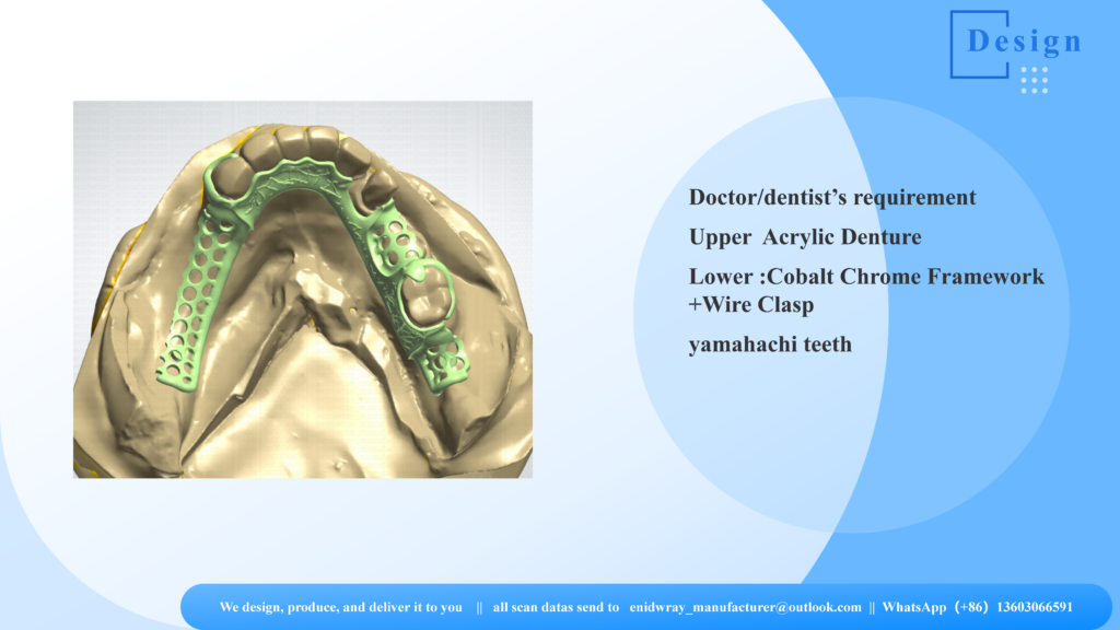 High-purity medical-grade cast Cobalt Chrome Framework for a partial lower denture with custom wrought wire clasps.