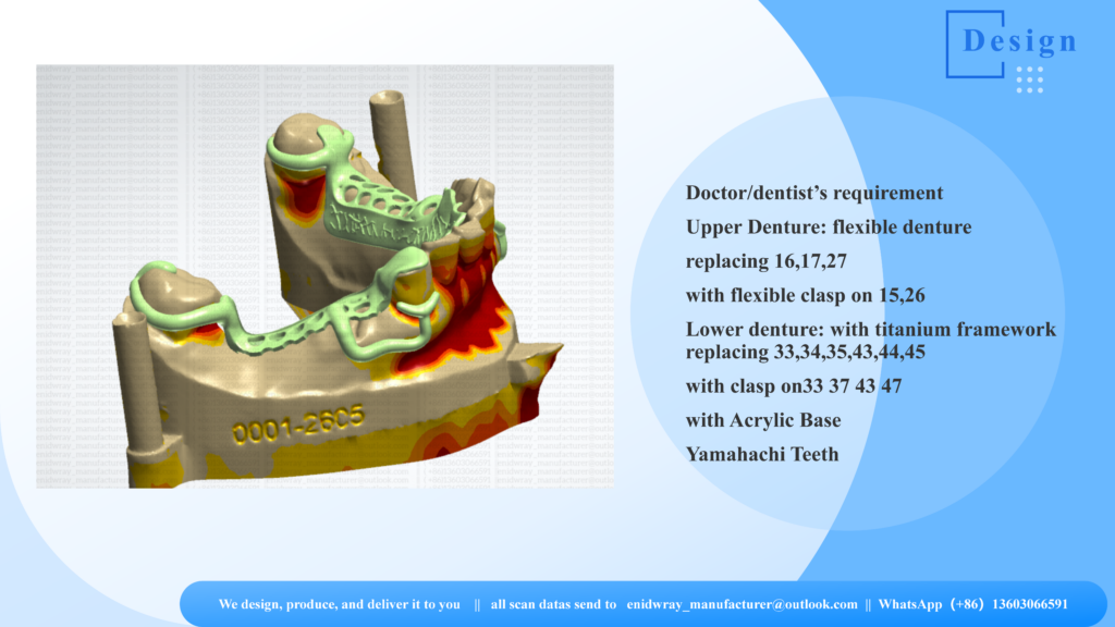 Medical-grade lightweight cast titanium framework for a lower partial denture with retention clasps on a refractory model.