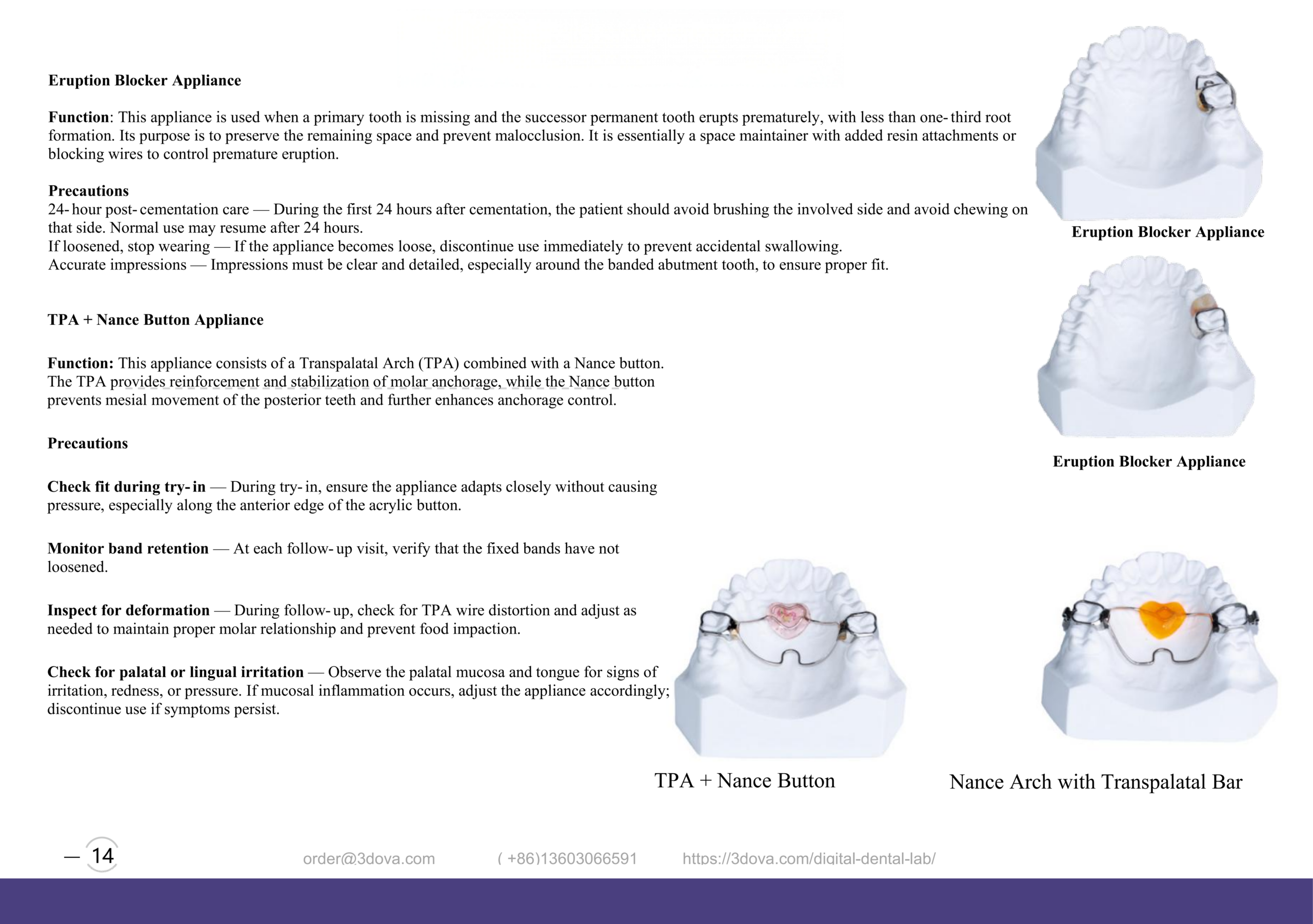 Orthodontic Nance Appliance: Max Anchorage Guide