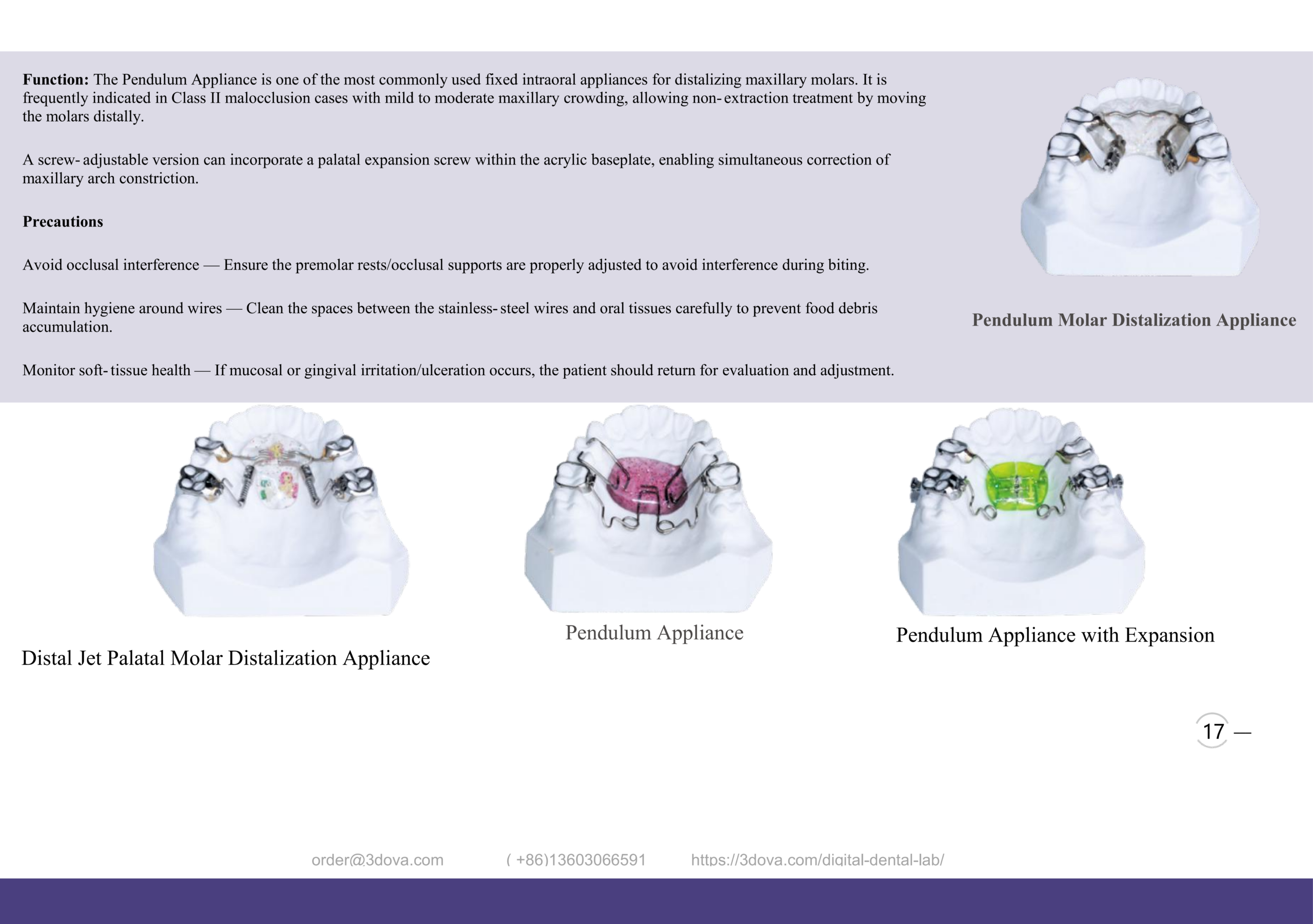 Pendulum Molar Distalization Appliance: Class II Fixes