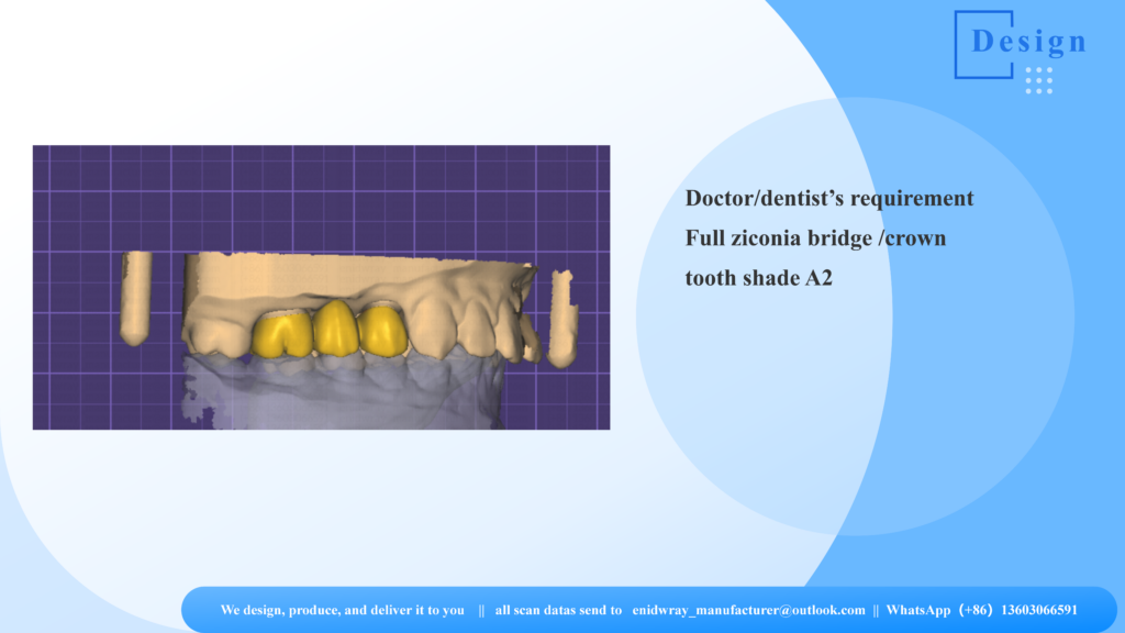 Dental lab technician hand-applying micro-layering external stains to a monolithic zirconia crown to achieve a perfect VITA shade A2.